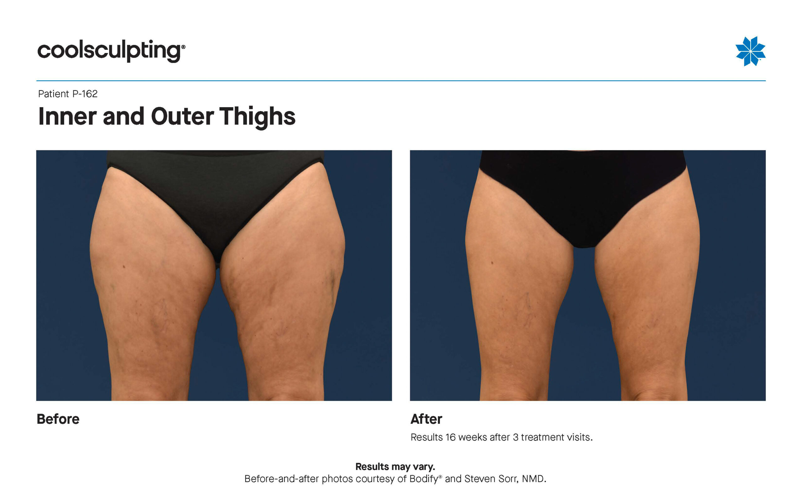 P-162 Inner Outer Thighs_Bodify (1)-2